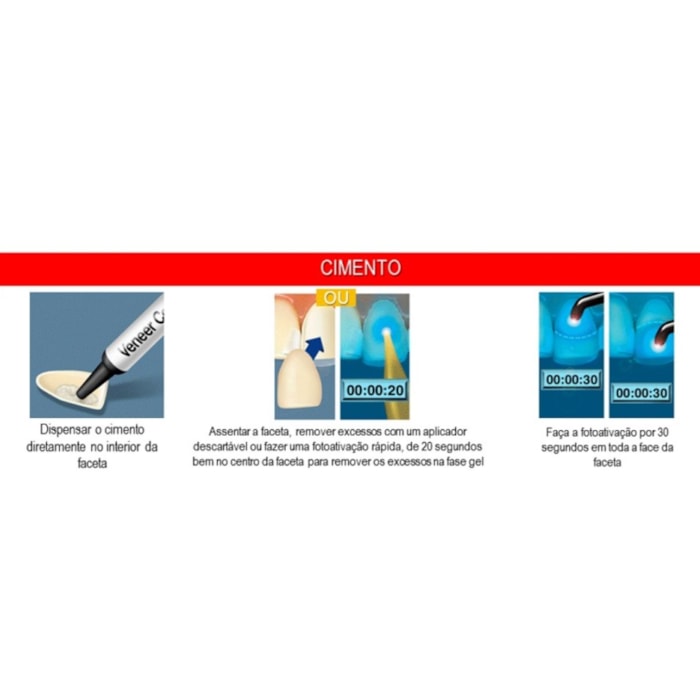 Cimento Resinoso 3M™ Foto RelyX™ Veneer - Solventum