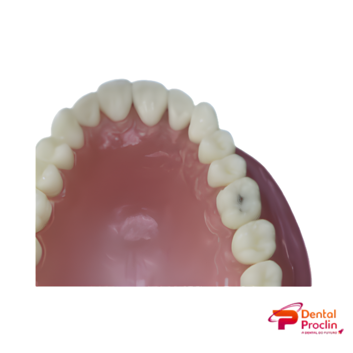 Dente Diferenciado Cárie Oculta DM 26.6 – Pronew