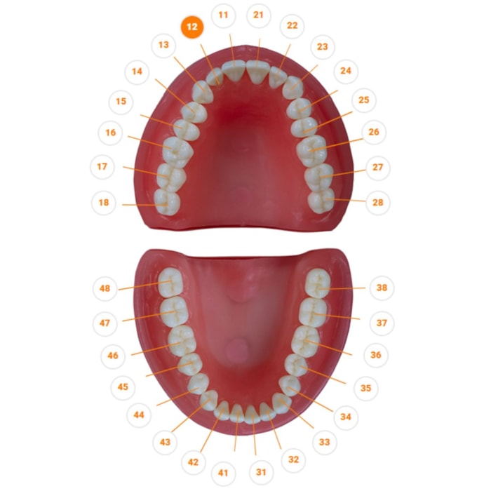 Dente Diferenciado Classe III Face MD Carido DM12.5 - Pronew