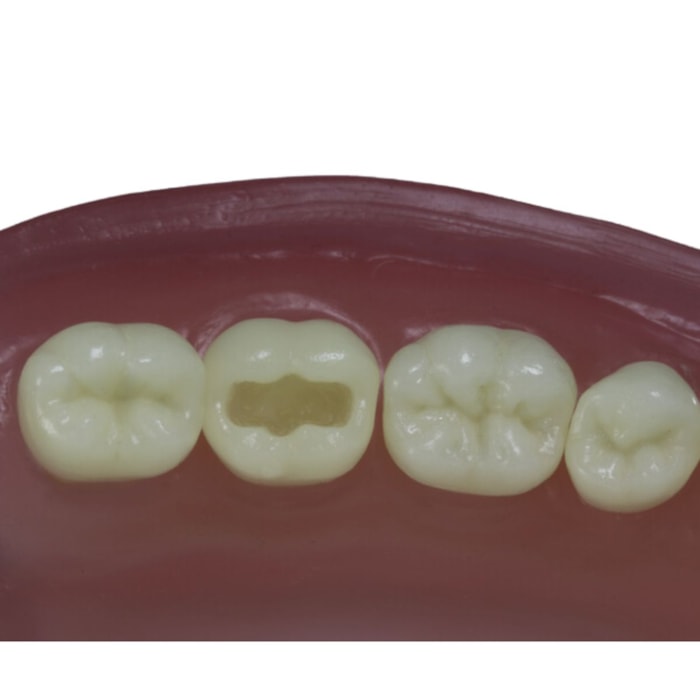 Dente para Manequim Classe 1 Face Oclusal DM37 - Pronew