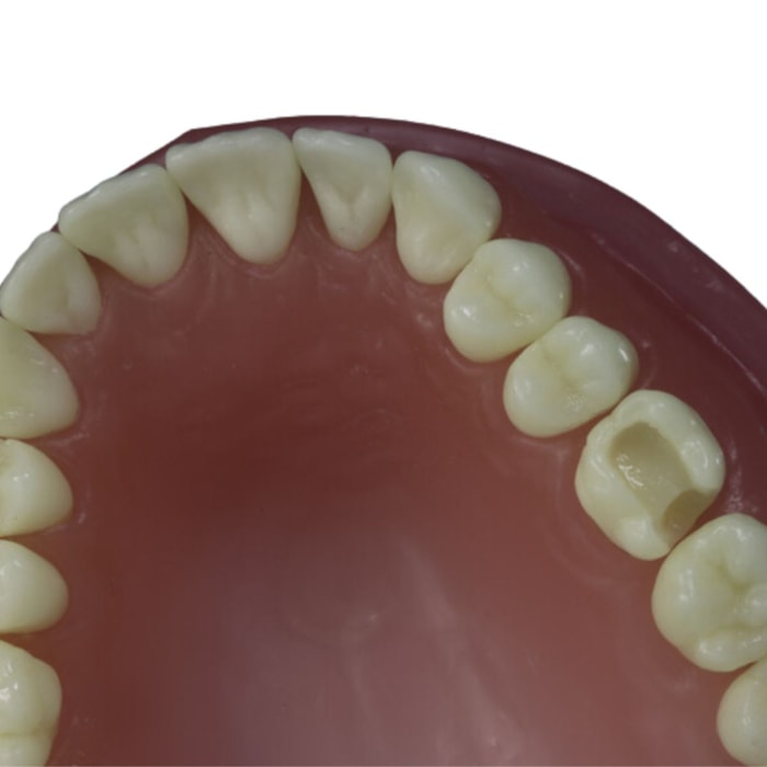 Dente para Manequim Classe 2 Amplo Face OD DM 26.5 - Pronew