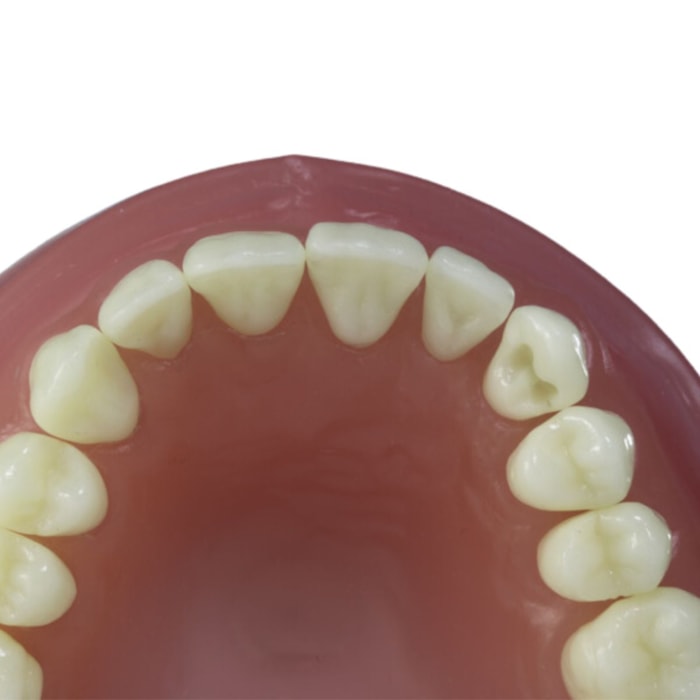 Dente para Manequim Classe 5 na Face Vestibular DM 23.2 - Pronew
