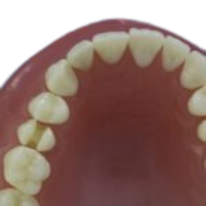 Dente para Manequim com Preparo Classe 2 Modelo DM15.3 - Pronew