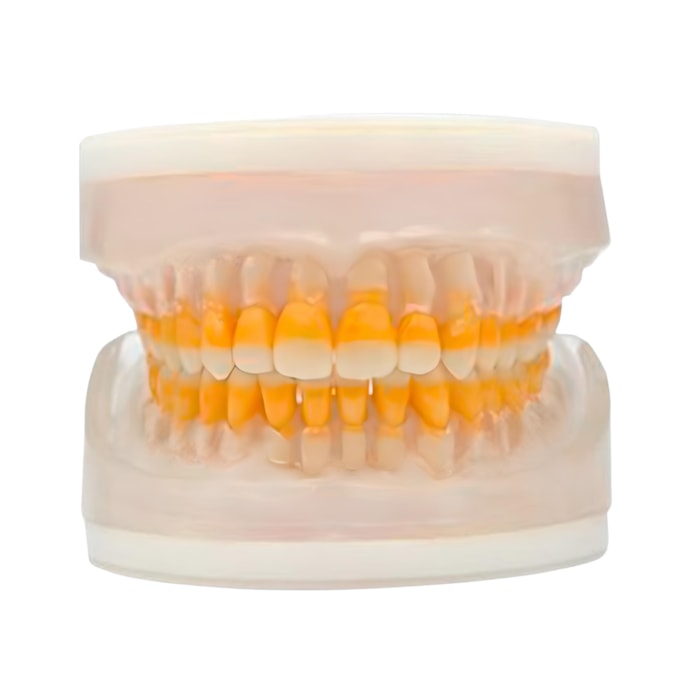 Manequim Refil de Periodontia AC104 - Pronew