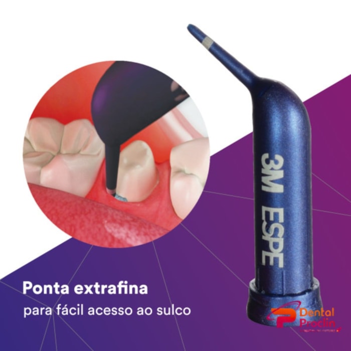 Pasta Adstringente de Afastamento Gengival 3M™ - Solventum