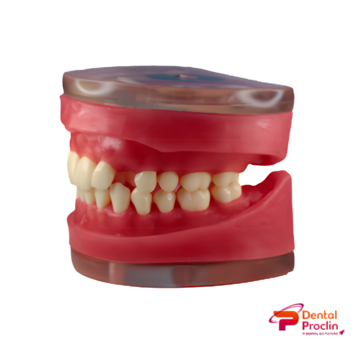 Refil Exodontia – Pronew