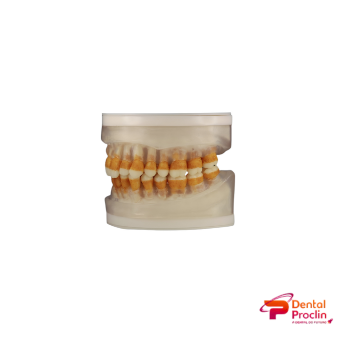 Refil Para Manequim de Periodontia AC104 - Pronew