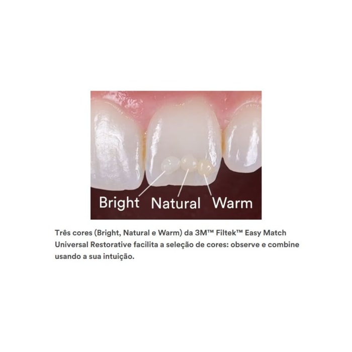 Resina Filtek™ 3M™ Easy Match - Solventum